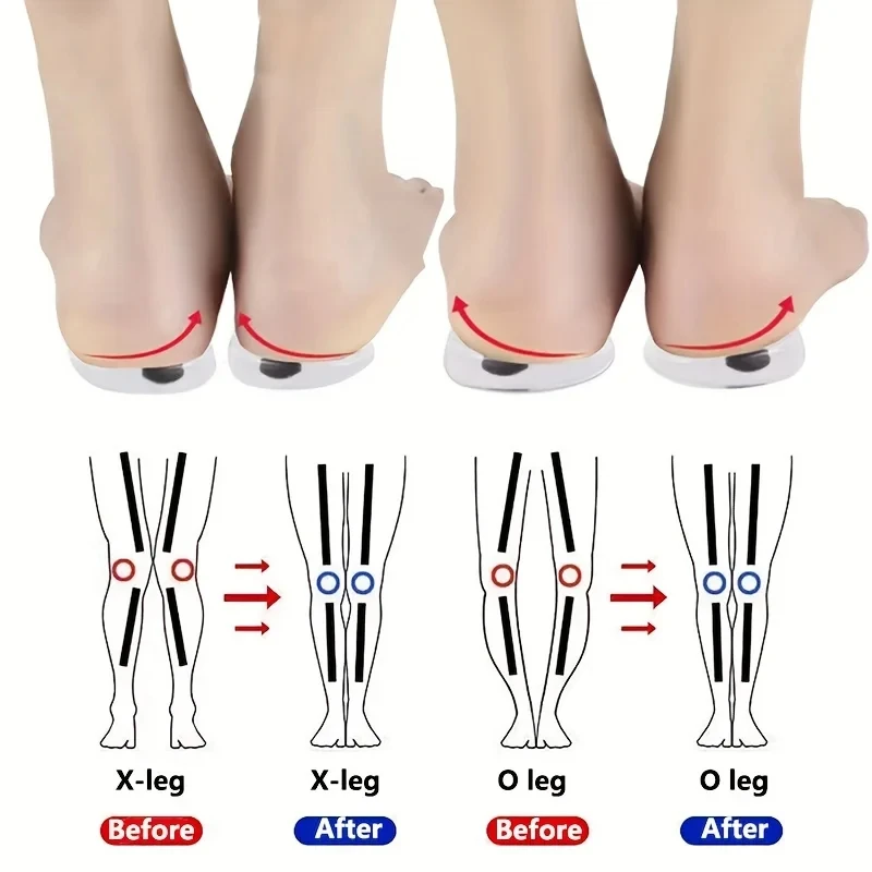 Women Shoes Types - 1 par de palmilhas ortopédicas para