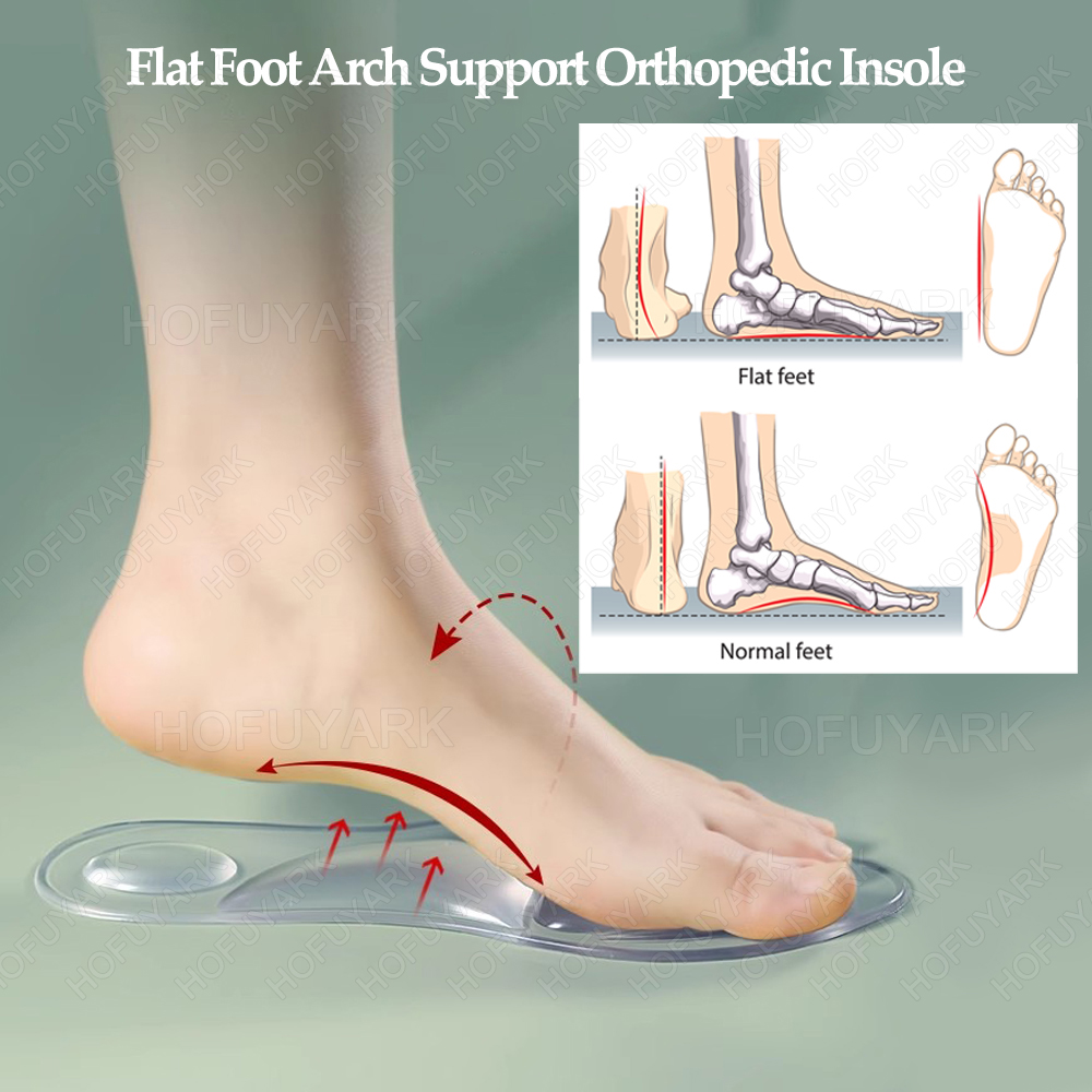 almilhas ortopédicas de gel de - Women'S Shoes High Arch Support avaliação e preço